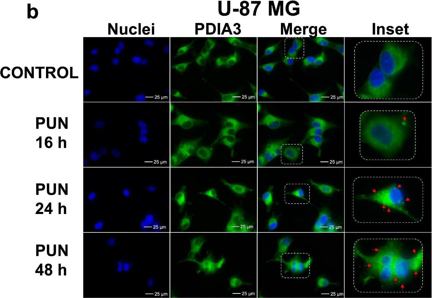 Fig.3.B showing Immunocytochemistry-immunofluorescence in a Homo sapiens (Human) sample from the publication: Protein Disulfide Isomerase A3 (PDIA3): A Pharmacological Target in Glioblastoma?
