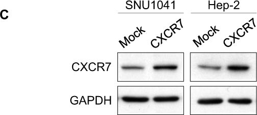 Fig.1.C showing Western Blotting in a Homo sapiens (Human) sample from the publication: CXCR7 promotes migration and invasion in head and neck squamous cell carcinoma by upregulating TGF-β1/Smad2/3 signaling.