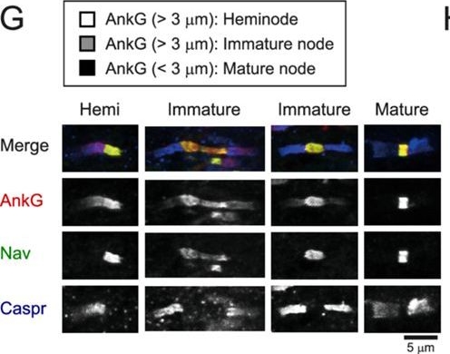 Fig.1.G showing Immunocytochemistry-immunofluorescence in a Gallus gallus domesticus (Chicken) sample from the publication: Regional heterogeneities of oligodendrocytes underlie biased Ranvier node spacing along single axons in sound localization circuit.