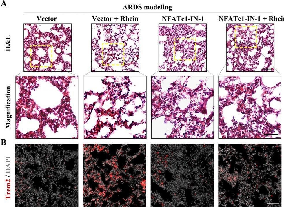 Fig.7.A from the publication: Rhein-attenuates LPS-induced acute lung injury via targeting NFATc1/Trem2 axis.