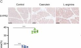 Fig.4.C showing Immunohistochemistry from the publication: SphK1/S1P signaling-mediated crosstalk between pancreatic acinar cell and macrophage M1 polarization aggravates acute pancreatitis progression.
