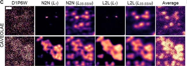 Fig.2.C showing Immunocytochemistry-immunofluorescence in a Homo sapiens (Human) sample from the publication: Label2label: training a neural network to selectively restore cellular structures in fluorescence microscopy.