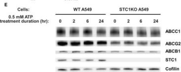 BTS CD16種類！ Anti-Phospho-p44/42 MAPK (Erk1/2) (Thr202/Tyr204) Rabbit