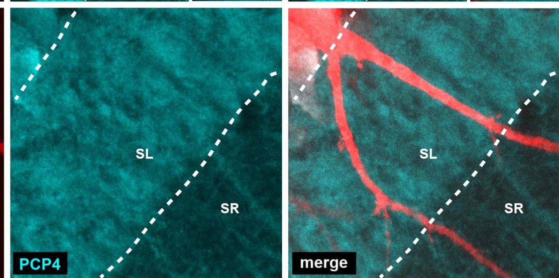 Fig.3.S showing Immunohistochemistry-immunofluorescence in a Mus musculus (House mouse) sample from the publication: Gradual transition of pyramidal cell types in the dorsal hippocampal area CA2b of the C57BL/6 mouse.