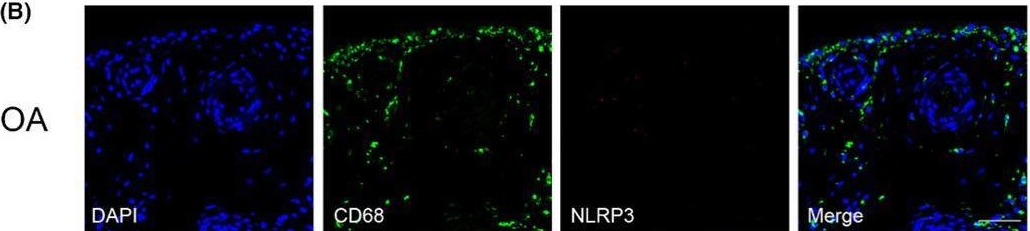 Fig.4.B showing Immunohistochemistry-immunofluorescence in a Homo sapiens (Human) sample from the publication: Pyroptosis by NLRP3/caspase-1/gasdermin-D pathway in synovial tissues of rheumatoid arthritis patients.