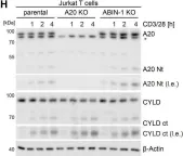 Fig.3.H showing Western Blotting from the publication: A20 and ABIN-1 cooperate in balancing CBM complex-triggered NF-κB signaling in activated T cells.