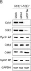 Fig.4.B showing Western Blotting from the publication: Cancerous inhibitor of protein phosphatase 2A contributes to human papillomavirus oncoprotein E7-induced cell proliferation via E2F1.