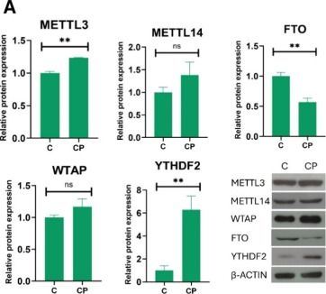Fig.4.A showing Western Blotting in a Homo sapiens (Human) sample from the publication: Carboplatin Is Associated with Changes in Components of the m6A Machinery in Triple-Negative Breast Cancer Cells.