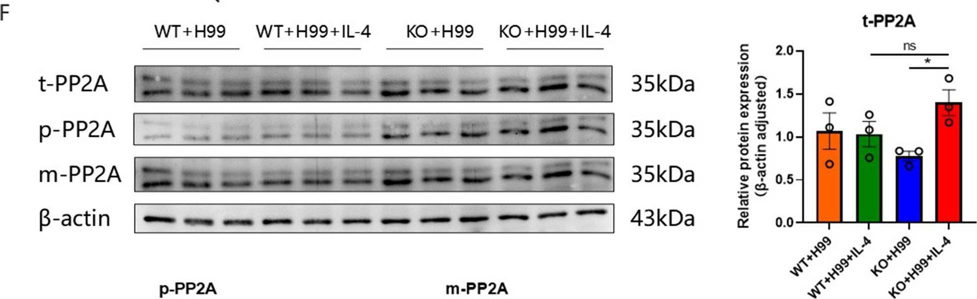 Fig.6.F showing Western Blotting in a Mus musculus (House mouse) sample from the publication: LincR-PPP2R5C deficiency enhancing the fungicidal activity of neutrophils in pulmonary cryptococcosis is linked to the upregulation of IL-4.