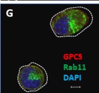 Fig.7.G showing Immunocytochemistry-immunofluorescence from the publication: Subcellular localization of glypican-5 is associated with dynamic motility of the human mesenchymal stem cell line U3DT.