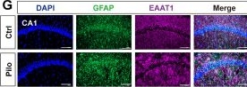 Fig.2.G showing Immunohistochemistry-immunofluorescence in a Mus musculus (House mouse) sample from the publication: The m6A reader YTHDC2 promotes the pathophysiology of temporal lobe epilepsy by modulating SLC7A11-dependent glutamate dysregulation in astrocytes.