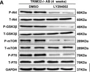 Fig.7.A showing Western Blotting from the publication: Tripartite motif 32 prevents pathological cardiac hypertrophy.