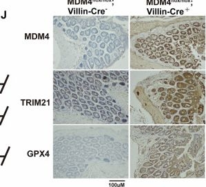 Fig.8.J showing Immunohistochemistry in a Mus musculus (House mouse) sample from the publication: MDM4 inhibits ferroptosis in p53 mutant colon cancer via regulating TRIM21/GPX4 expression.