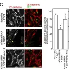 Fig.5.C showing Immunocytochemistry-immunofluorescence from the publication: An Adaptor Molecule Afadin Regulates Lymphangiogenesis by Modulating RhoA Activity in the Developing Mouse Embryo.
