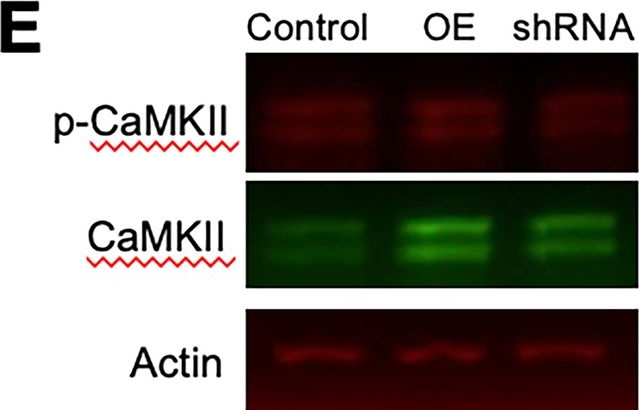 Fig.8.E showing Western Blotting in a Mus musculus (House mouse) sample from the publication: Rasal1 regulates calcium dependent neuronal maturation by modifying microtubule dynamics.