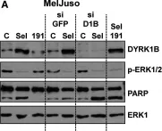 Fig.7.A showing Western Blotting from the publication: Identification of DYRK1B as a substrate of ERK1/2 and characterisation of the kinase activity of DYRK1B mutants from cancer and metabolic syndrome.