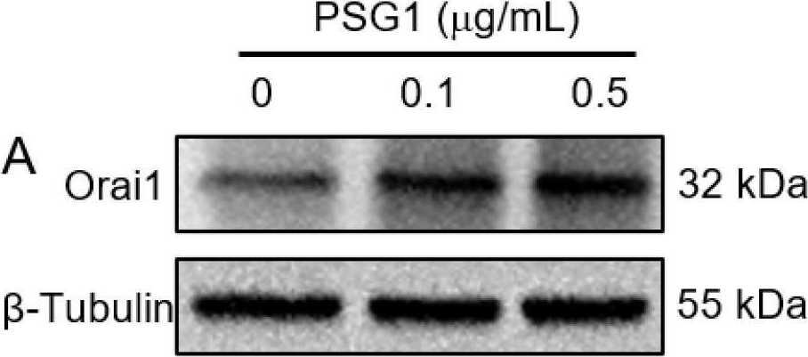Fig.4.A showing Western Blotting in a Homo sapiens (Human) sample from the publication: Pregnancy-Specific Beta-1-Glycoprotein 1 Increases HTR-8/SVneo Cell Migration through the Orai1/Akt Signaling Pathway.