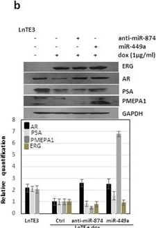 Fig.3.B showing Western Blotting from the publication: Loss of miR-449a in ERG-associated prostate cancer promotes the invasive phenotype by inducing SIRT1.