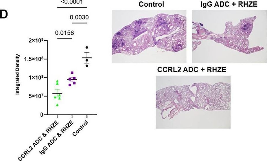Fig.2.D showing Immunohistochemistry in a Mus musculus (House mouse) sample from the publication: Targeting CCRL2 enhances therapeutic outcomes in a tuberculosis mouse model.