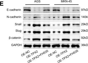 Fig.6.E showing Western Blotting from the publication: TPX2 promotes gastric cancer progression and angiogenesis via Wnt/β-catenin signaling.
