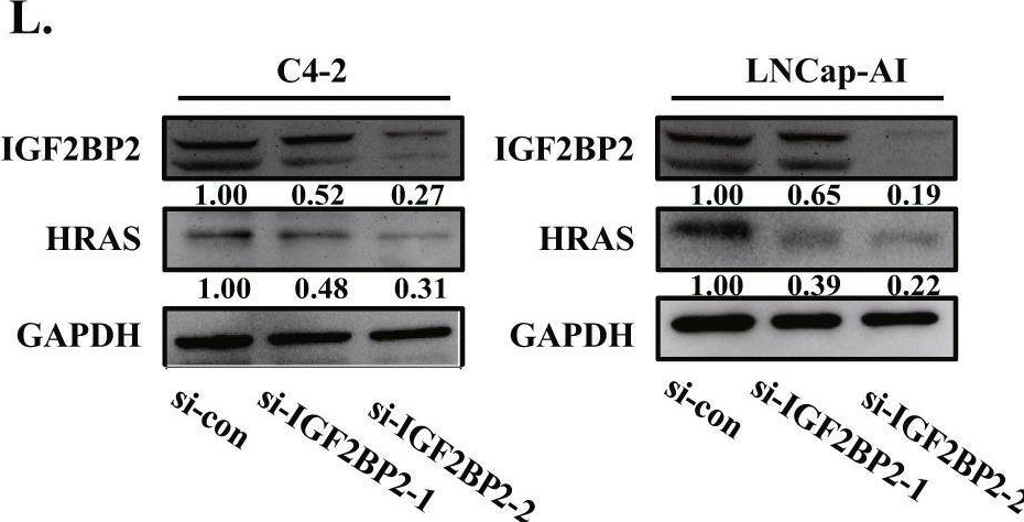 Fig.5.L showing Western Blotting from the publication: Post-transcriptional modification of m6A methylase METTL3 regulates ERK-induced androgen-deprived treatment resistance prostate cancer.