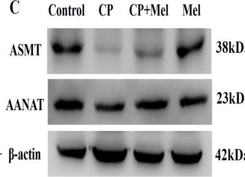 Fig.7.C showing Western Blotting from the publication: Activation of MT1/MT2 to Protect Testes and Leydig Cells against Cisplatin-Induced Oxidative Stress through the SIRT1/Nrf2 Signaling Pathway.