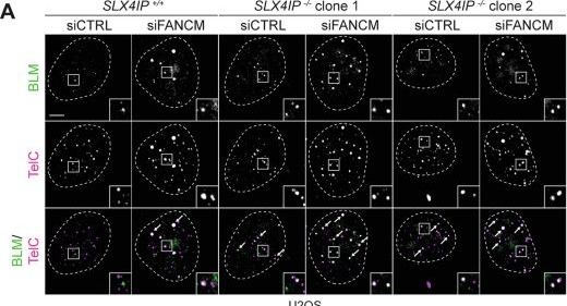 Fig.6.A showing Immunocytochemistry-immunofluorescence from the publication: SLX4IP limits replication stress globally and at ALT telomeres.