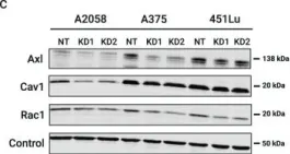 Fig.3.C showing Western Blotting from the publication: SRC-RAC1 signaling drives drug resistance to BRAF inhibition in de-differentiated cutaneous melanomas.