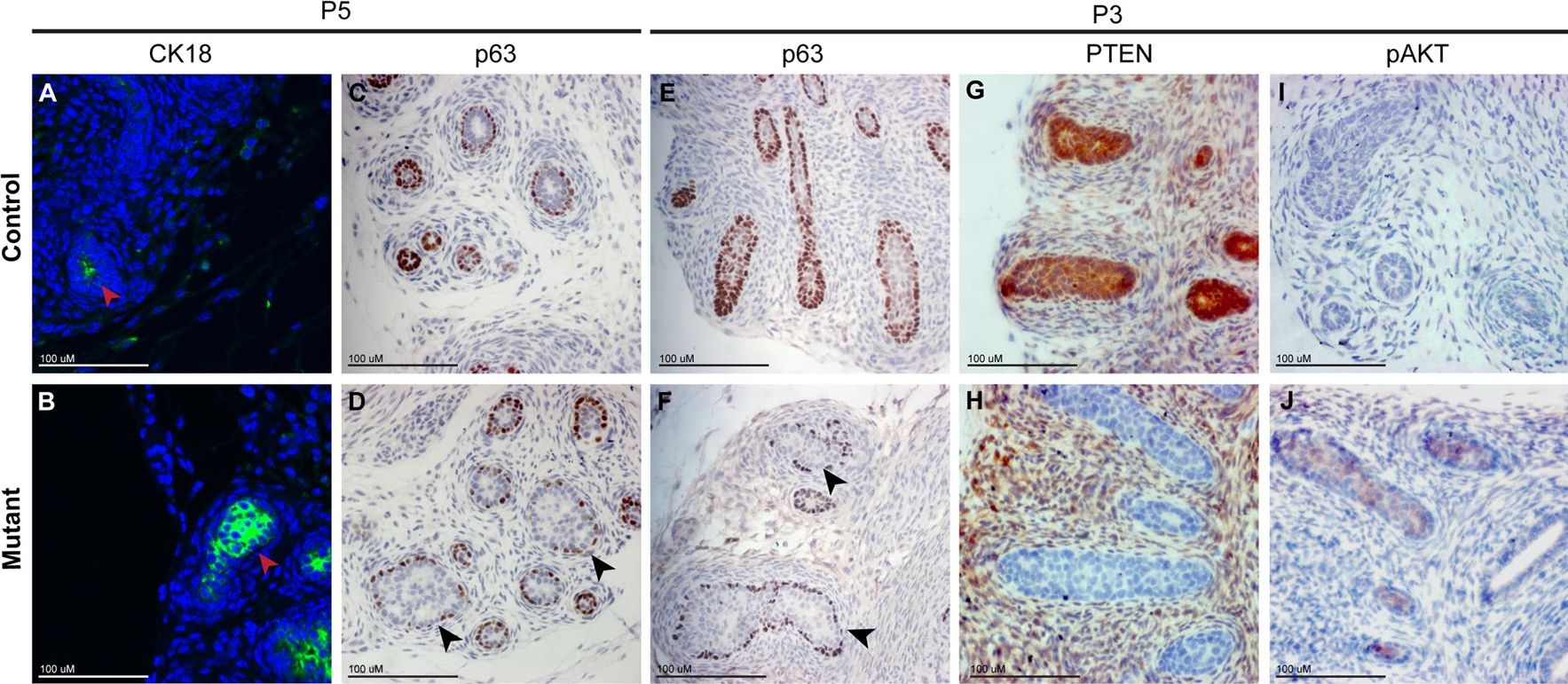 Pten Regulates Epithelial Cytodifferentiation during Prostate Development.