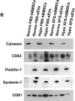 Fig.2.B showing Western Blotting in a Homo sapiens (Human) sample from the publication: Xeno-free cultured mesenchymal stromal cells release extracellular vesicles with a "therapeutic" miRNA cargo ameliorating cartilage inflammation in vitro.