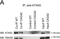 Fig.2.A showing Western Blotting in a Mus musculus (House mouse) sample from the publication: Both ubiquitin ligases FBXW8 and PARK2 are sequestrated into insolubility by ATXN2 PolyQ expansions, but only FBXW8 expression is dysregulated.