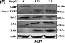 Fig.3.E showing Western Blotting from the publication: Ro 31-8220 suppresses bladder cancer progression via enhancing autophagy in vitro and in vivo.