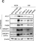 Fig.1.C showing Western Blotting from the publication: Co-Targeting FASN and mTOR Suppresses Uveal Melanoma Growth.
