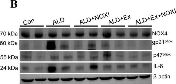 Fig.3.B showing Western Blotting in a Mus musculus (House mouse) sample from the publication: Exercise Affects the Formation and Recovery of Alcoholic Liver Disease through the IL-6-p47phox Oxidative-Stress Axis.