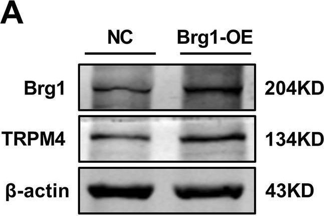 Fig.1.A showing Western Blotting in a Mus musculus (House mouse) sample from the publication: Brg1 and RUNX1 synergy in regulating TRPM4 channel in mouse cardiomyocytes.