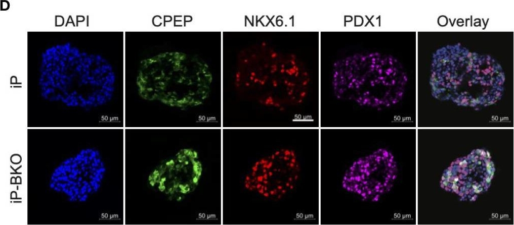 Fig.3.D showing Immunocytochemistry-immunofluorescence in a Homo sapiens (Human) sample from the publication: Protecting Stem Cell Derived Pancreatic Beta-Like Cells From Diabetogenic T Cell Recognition.