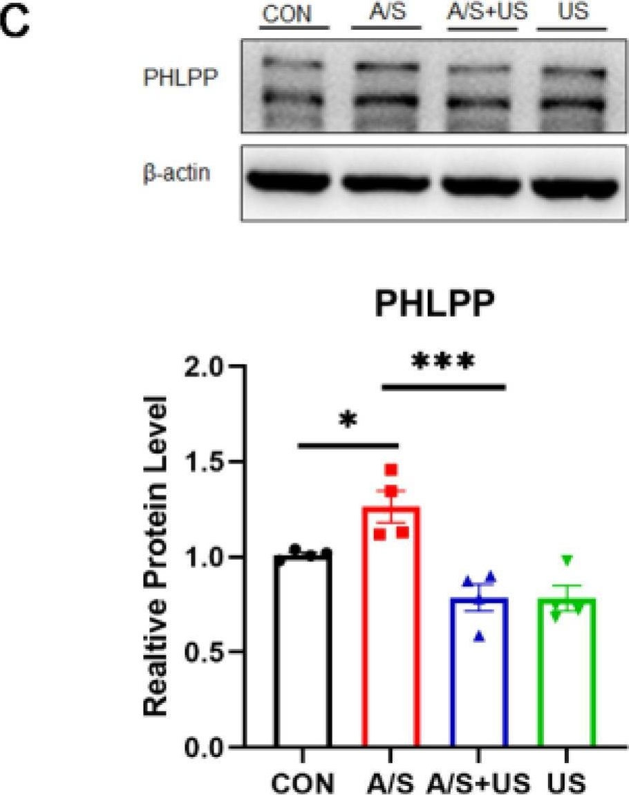 Fig.6.C showing Western Blotting in a Mus musculus (House mouse) sample from the publication: Low-Intensity Pulsed Ultrasound Attenuates Postoperative Neurocognitive Impairment and Salvages Hippocampal Synaptogenesis in Aged Mice.