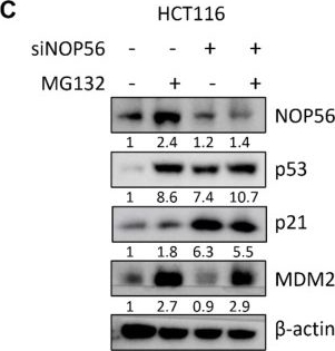 Fig.4.C showing Western Blotting from the publication: NOP56 Drives Colorectal Cancer Progression by Modulating p53 Acetylation through SIRT1/p300.