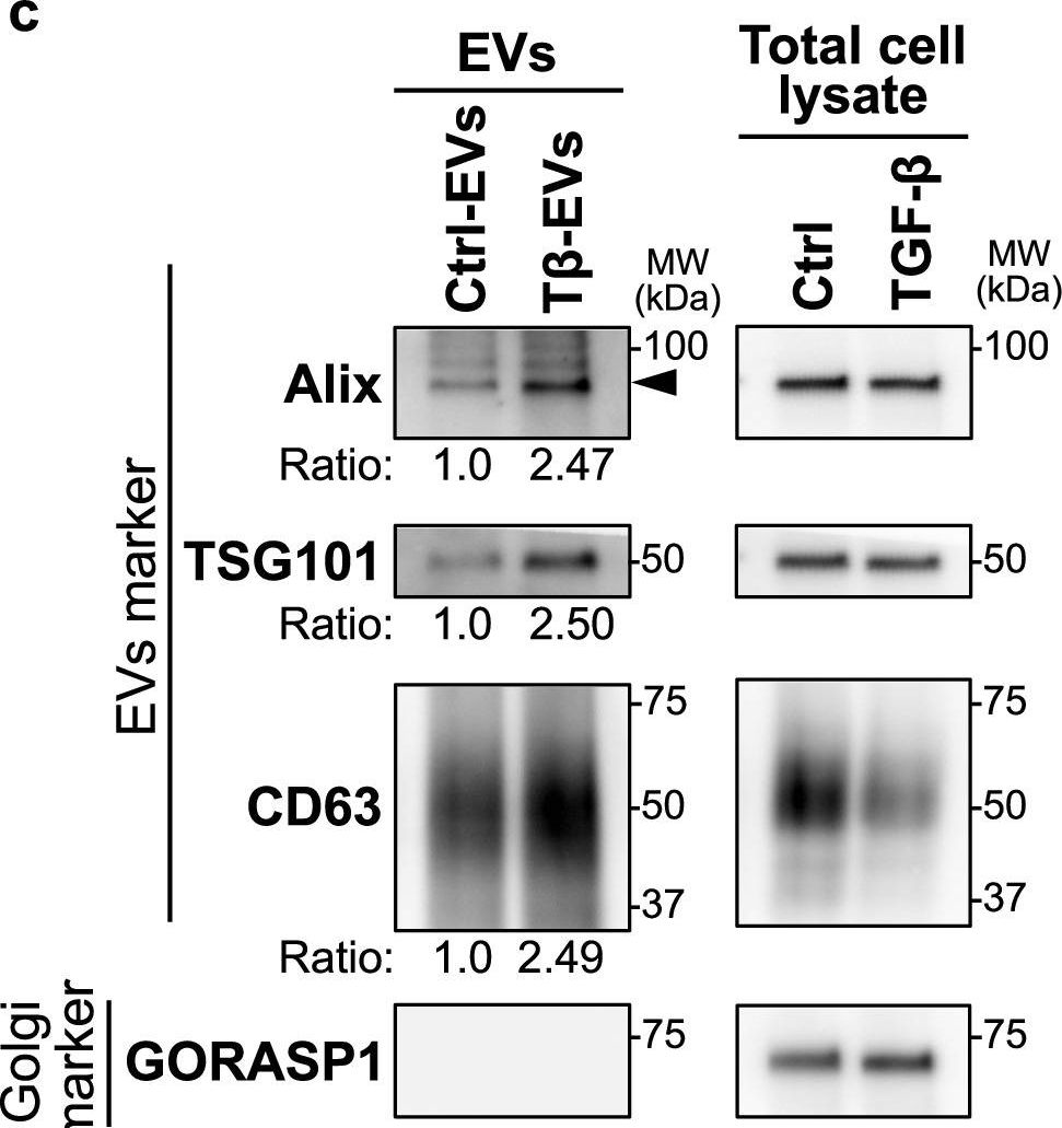 Fig.2.C showing Western Blotting from the publication: Transforming growth factor-β-induced secretion of extracellular vesicles from oral cancer cells evokes endothelial barrier instability via endothelial-mesenchymal transition.