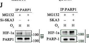 Fig.5.J showing Western Blotting from the publication: Hypoxia-induced SKA3 promoted cholangiocarcinoma progression and chemoresistance by enhancing fatty acid synthesis via the regulation of PAR-dependent HIF-1a deubiquitylation.