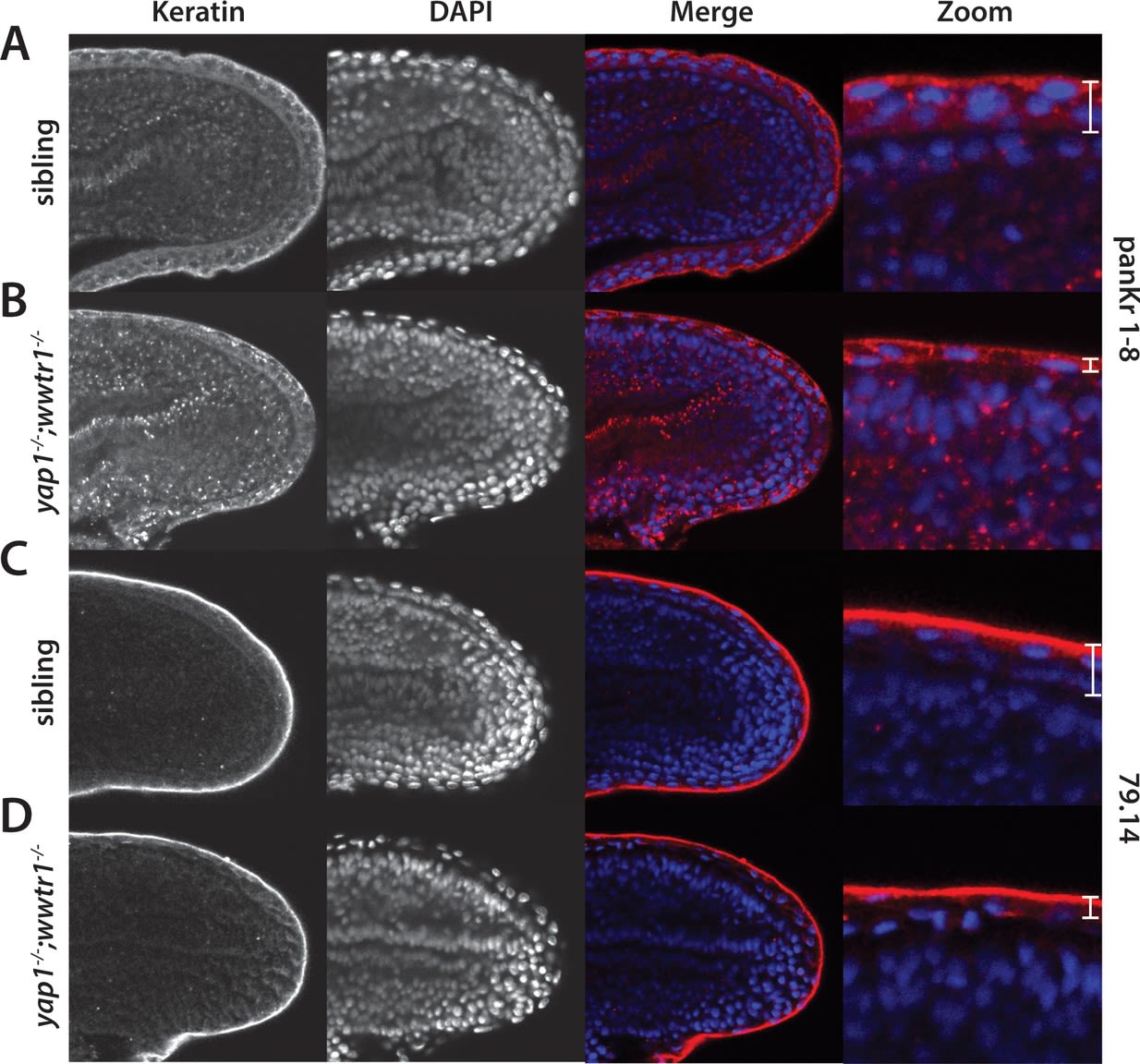 Regulation of posterior body and epidermal morphogenesis in zebrafish by localized Yap1 and Wwtr1.