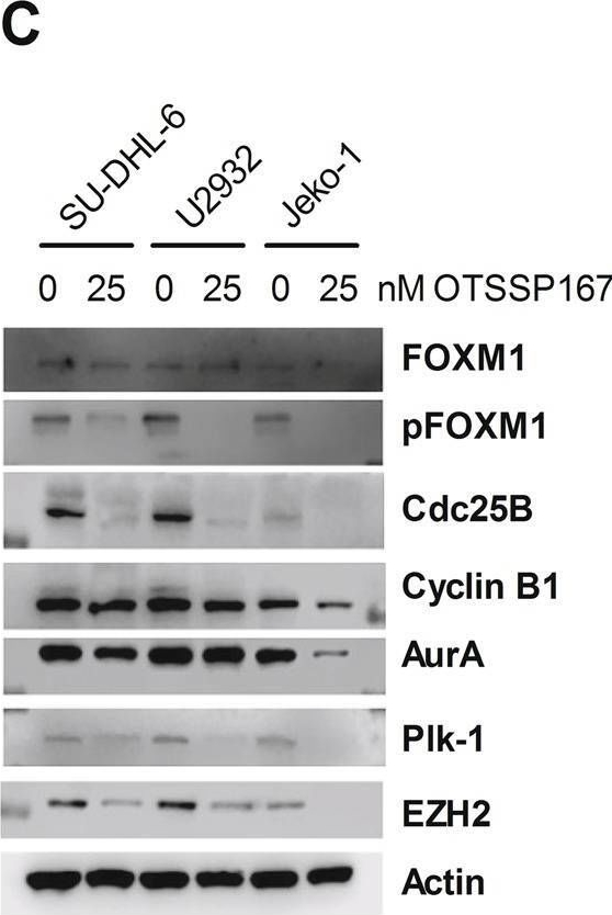 Fig.3.C showing Western Blotting from the publication: Maternal embryonic leucine zipper kinase is a novel target for diffuse large B cell lymphoma and mantle cell lymphoma.