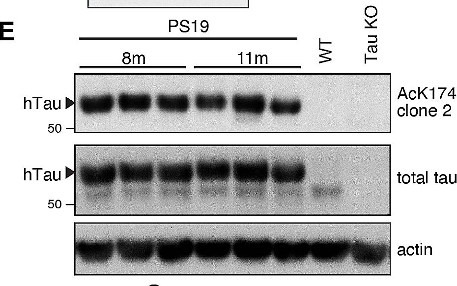 Fig.1.E showing Western Blotting in a Mus musculus (House mouse) sample from the publication: Anti-acetylated-tau immunotherapy is neuroprotective in tauopathy and brain injury.