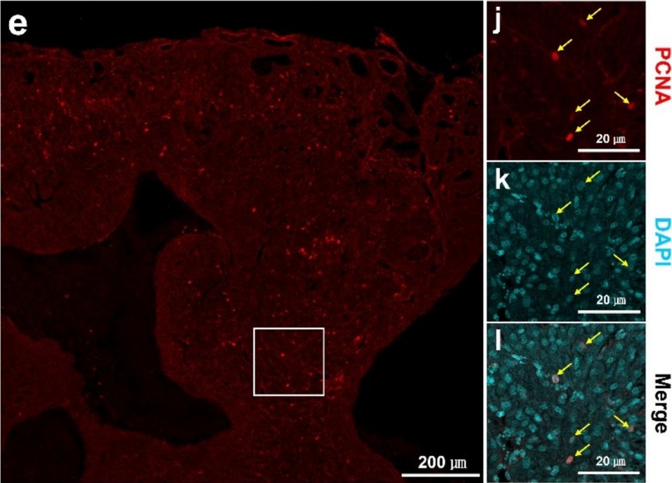 Fig.3.E showing Immunohistochemistry-immunofluorescence from the publication: ATF3 overexpression is associated with cardiac hypertrophy and electrical dysfunction accompanied by enhanced cardiac cell proliferation in zebrafish.
