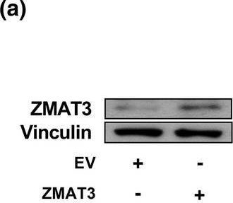 Fig.4.A showing Western Blotting in a Homo sapiens (Human) sample from the publication: ZMAT3 hypomethylation contributes to early senescence of preadipocytes from healthy first-degree relatives of type 2 diabetics.