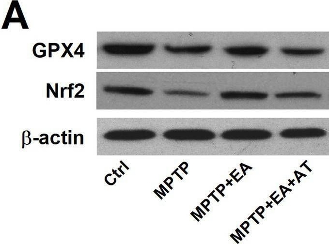 Fig.4.A showing Western Blotting in a Mus musculus (House mouse) sample from the publication: The mechanism of electroacupuncture-mediated improvement in Parkinson's disease by inhibiting ferroptosis through activating the Nrf2/GPX4 signal pathway.