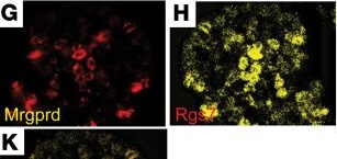 Fig.4.G showing Immunohistochemistry-immunofluorescence in a Mus musculus (House mouse) sample from the publication: Specific regulation of mechanical nociception by Gβ5 involves GABA-B receptors.