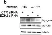 Fig.4.B showing Western Blotting from the publication: Pharmacological inhibition of EZH2 as a promising differentiation therapy in embryonal RMS.