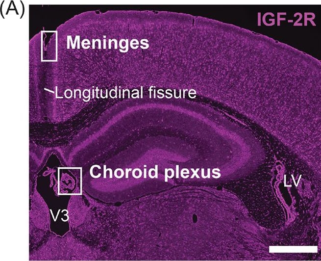 Fig.8.A showing Immunohistochemistry-immunofluorescence from the publication: Distribution and Levels of Insulin-like Growth Factor 2 Receptor Across Mouse Brain Cell Types.