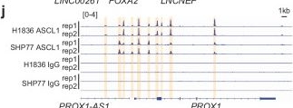 Fig.5.J from the publication: FOXA2 promotes metastatic competence in small cell lung cancer.